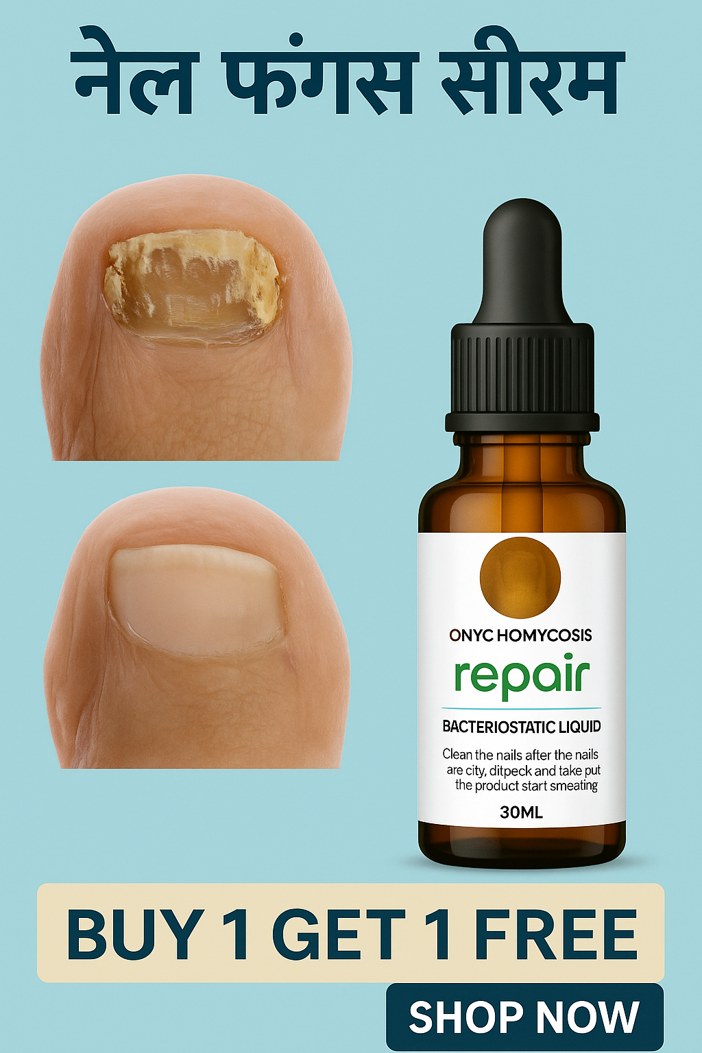 नेल फंगस सीरम - Nail Repair™PACK OF 2